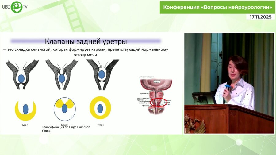 Соттаева З.З. - Клапанный мочевой пузырь. Как избежать подобных проблем?
