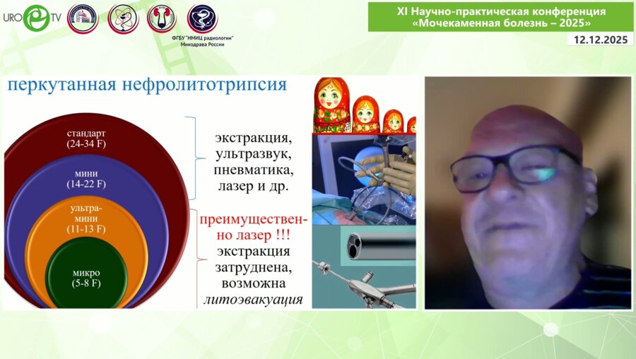 Мартов А.Г. - Настоящее и будущее перкутанной хирургии мочекаменной болезни