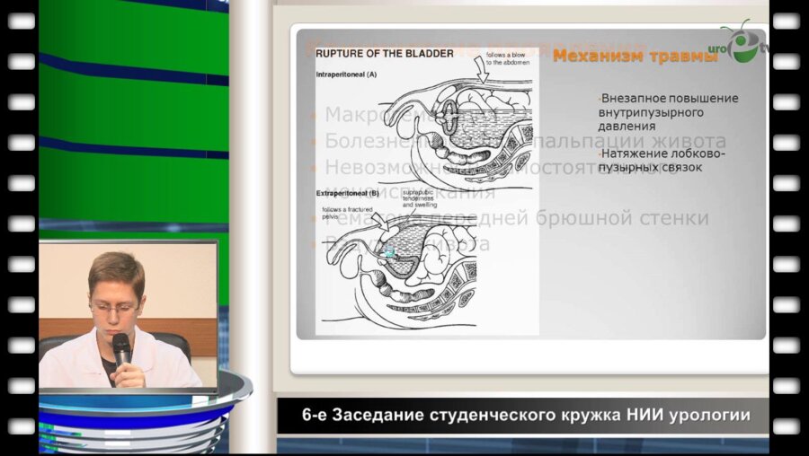 Либерзон И. - Травмы мочевого пузыря
