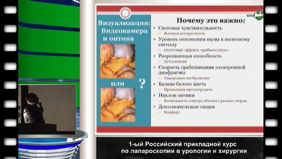 Луцевич О.Э. - "Оборудование и расходные материалы для лапароскопии"