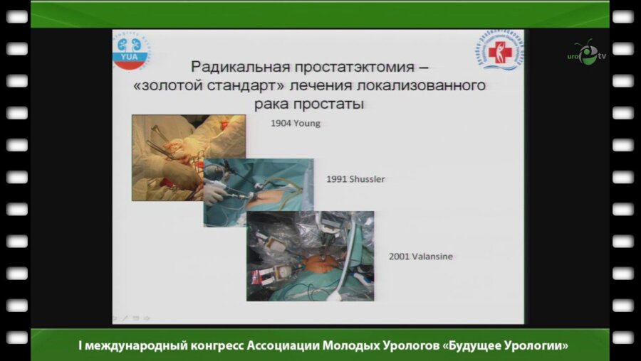 Абдуллин И.И. - "Лапароскопическая радикальная простатэктомия, опыт первых 100 операций"