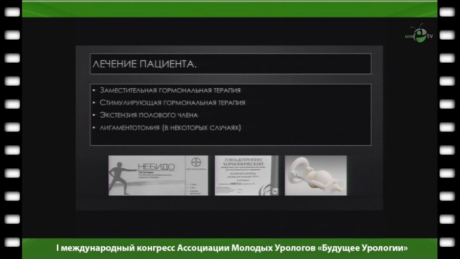 Сокольщик М.М. - "Сексуальная реабилитация пациентов с гипогонадизмом"
