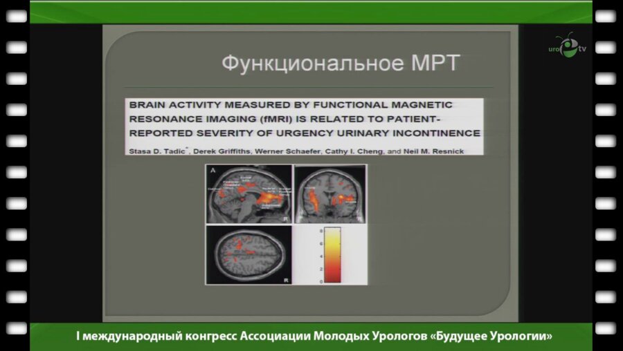 Касян Г.Р. - "Гиперактивный мочевой пузырь"