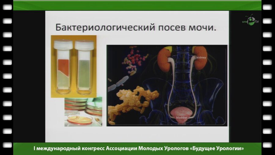 Тищенко Г.Е. - "Верификация микроорганизмов у амбулаторных и стационарных пациентов урологического профиля"