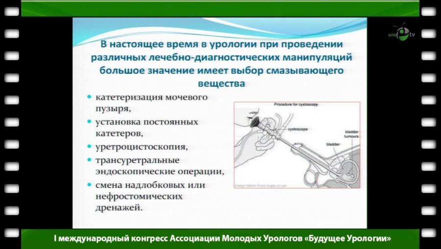 Колбасов Д.Н. - "Применение любрикантов в урологии"