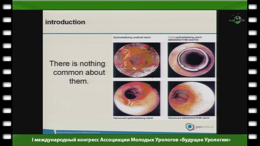 Осама Т. Абдулдахаб - "Применение металических стентов в урологии"