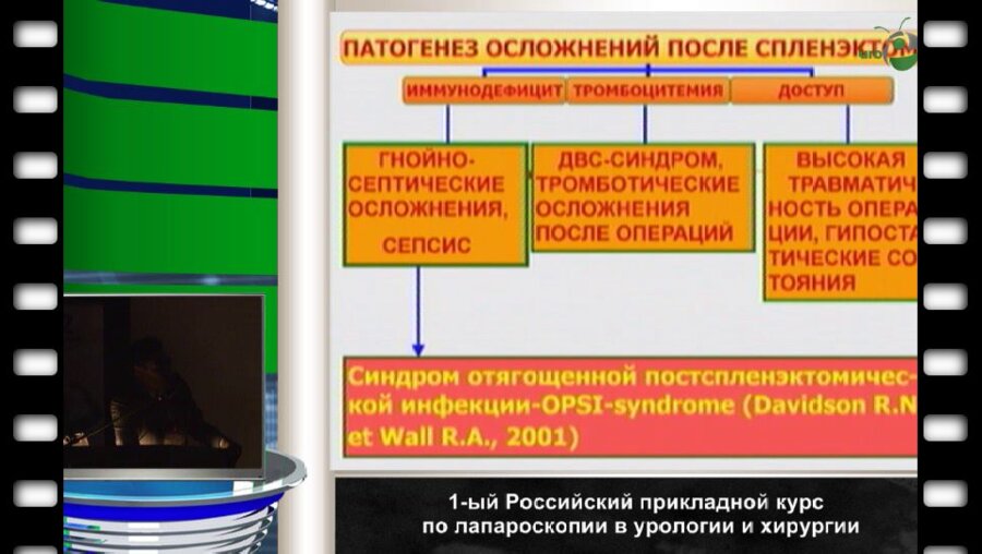 Тимербулатов М.В. - Лапароскопические операции в хирургии селезенки