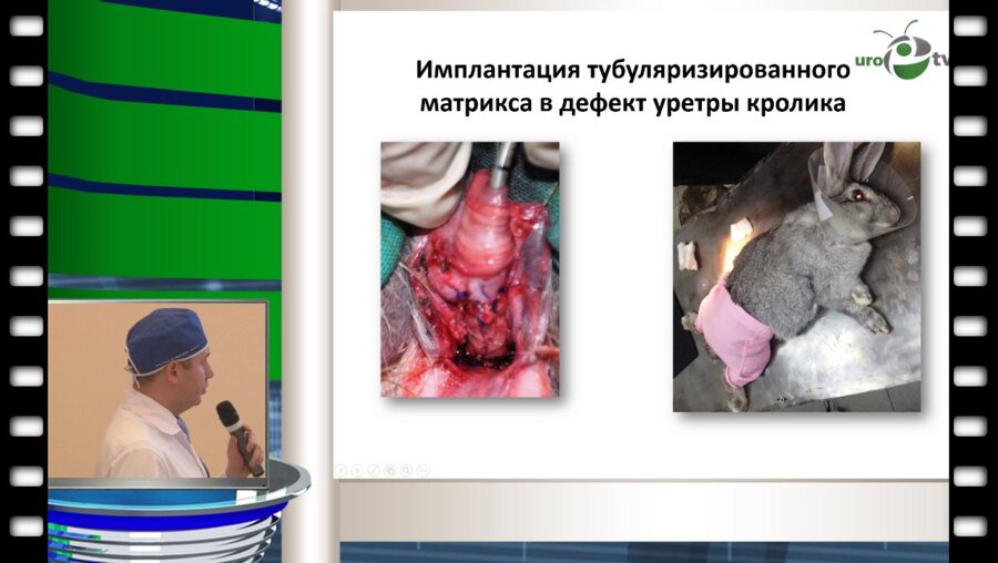 Бутнар Д.В. - "Заместительная уретропластика с использованием ткане - инженерной конструкции на основе децеллюлязированной трупной артерии и аутологичных эпителиоцитов щеки (оперативная техника - Asopa)"