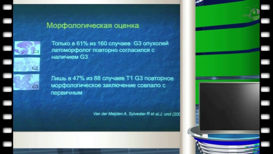 Серегин И.В. - "Нужна ли повторная ТУР при опухолях мочевого пузыря"