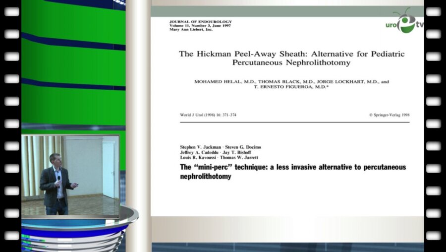 Бровкин С.С. - "Перкутанная нефролитотрипсия - результаты технических инноваций"