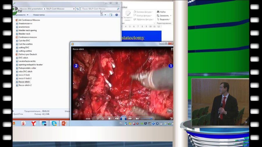 S.Gozen - Robot - assisted radical prostatectomy
