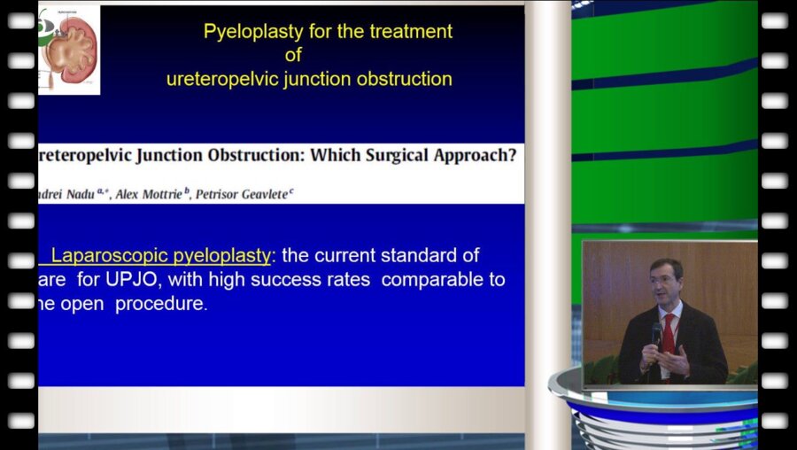 S.Gozen - Robotic retroperitoneal pyeloplasty