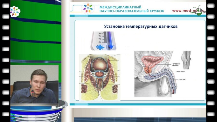 Печеркин А.А. - "Криоабляция"