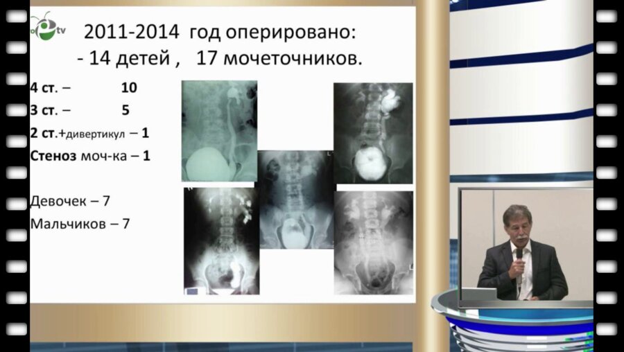 С.Г. Врублевский - Эндохирургическая уретсроцистоимплантация у детей