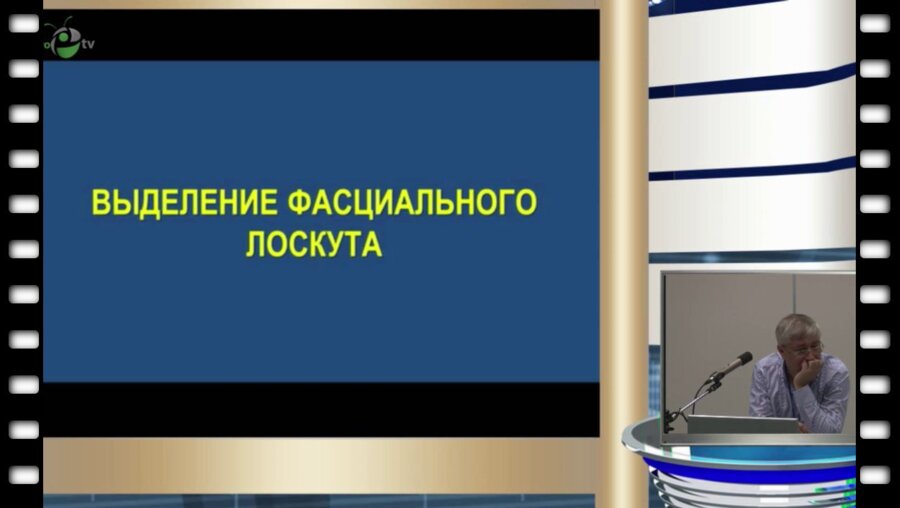 В.В. Сизонов - Результаты использования оригинальной технологии фиксации «конфликтного» сосуда при вазоуретральном конфликте у детей