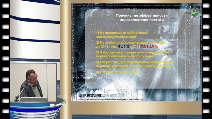 И.Л. Бабанин - Профилактика миграции синтетических имплантатов при эндоскопическом лечении пузырно-мочеточникового рефлюкса у детей