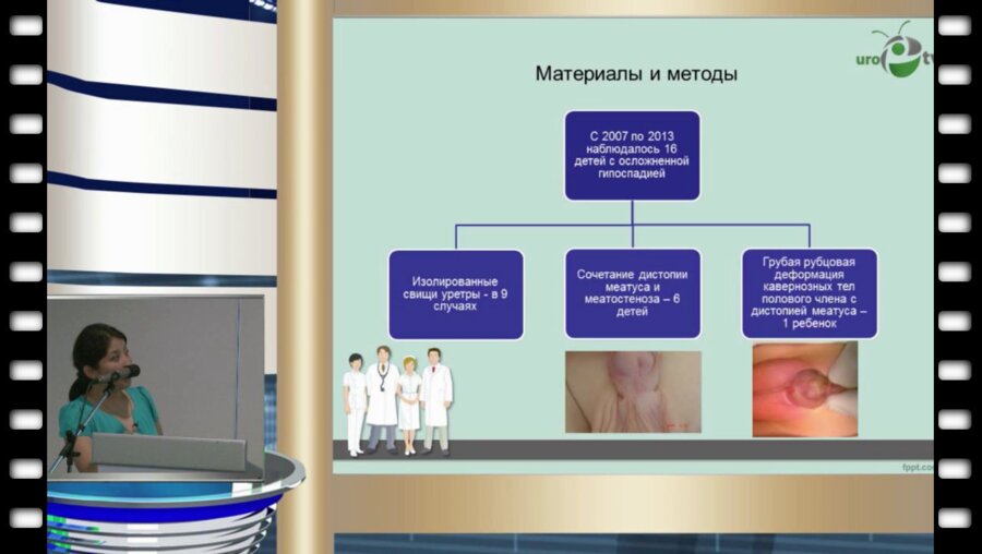  А.К. Нугуманова - Осложненная гипоспадия.wmv