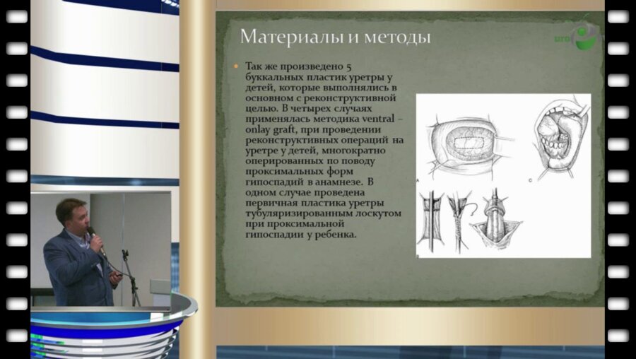 В.Д. Титов - К вопросу о выборе метода пластики уретры у детей