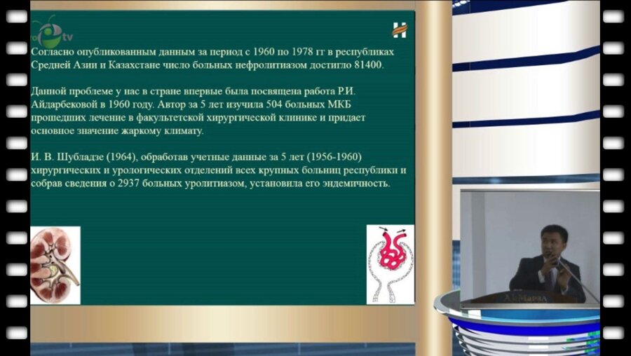 Ч.Б. Алимов - Состояние мочекаменной болезни в Кыргызстане
