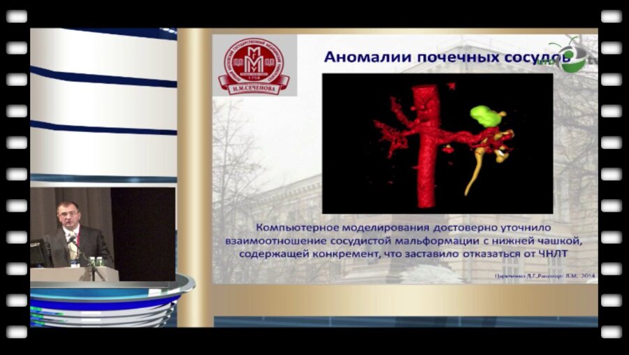 Цариченко Д.Г. - "Трехмерная анатомия при заболеваниях аномалийных почек"