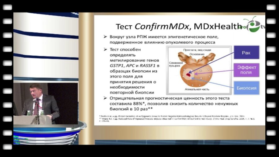 Каприн А.Д. - "Молекулярно-биологические факторы прогноза у больных раком простаты"