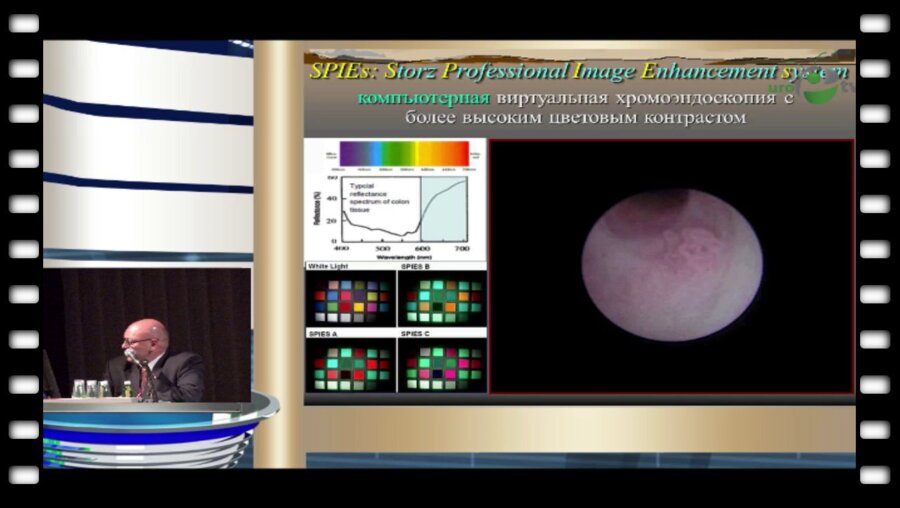 Мартов А.Г. - "Современные методы эндоскопической диагностики и лечения папиллярных опухолей ВМП"
