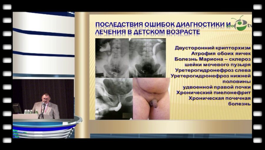 Павлов А.Ю. - "Интегративные преемственные подходы в детской и взрослой урологии"
