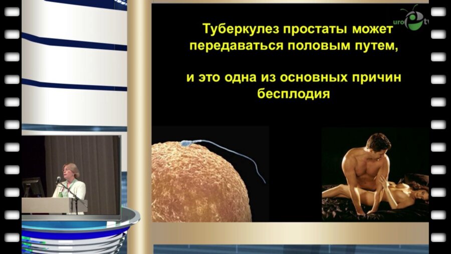 Кульчавеня Е.В. - "Оптимизация подхода к химиотерапии больных туберкулезом простаты"