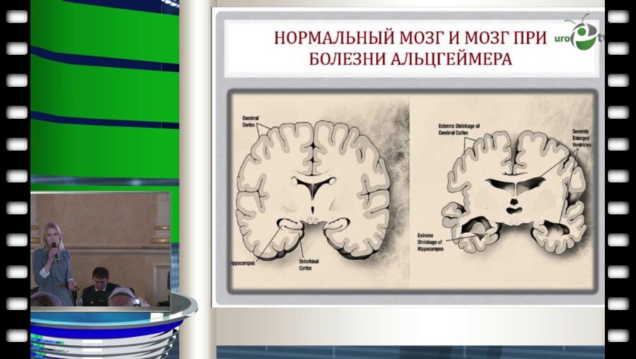 Тишова Ю.А. - Болезнь Альцгеймера - диабет 3 типа?