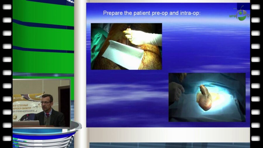 Enrique Lledo-Garcia - Особенности эндофаллопротезирования