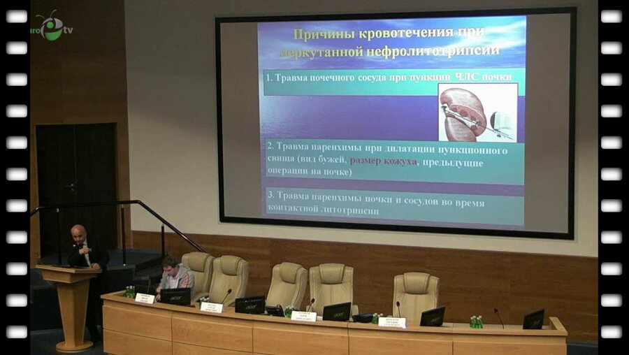 Гулиев Б.Г. - Перкутанная нефролитотрипсия: стандартная или Miniperc