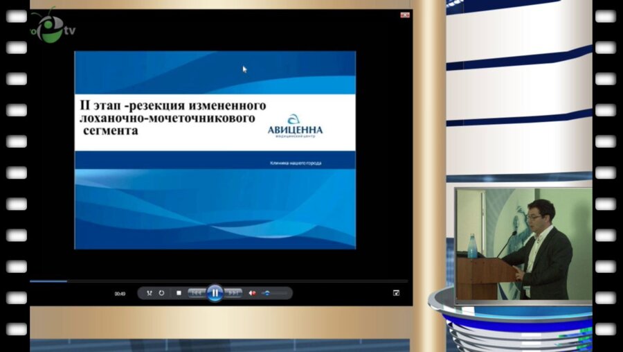 Холтобин Д.П. - Место лапароскопии в лечении стриктур мочеточника
