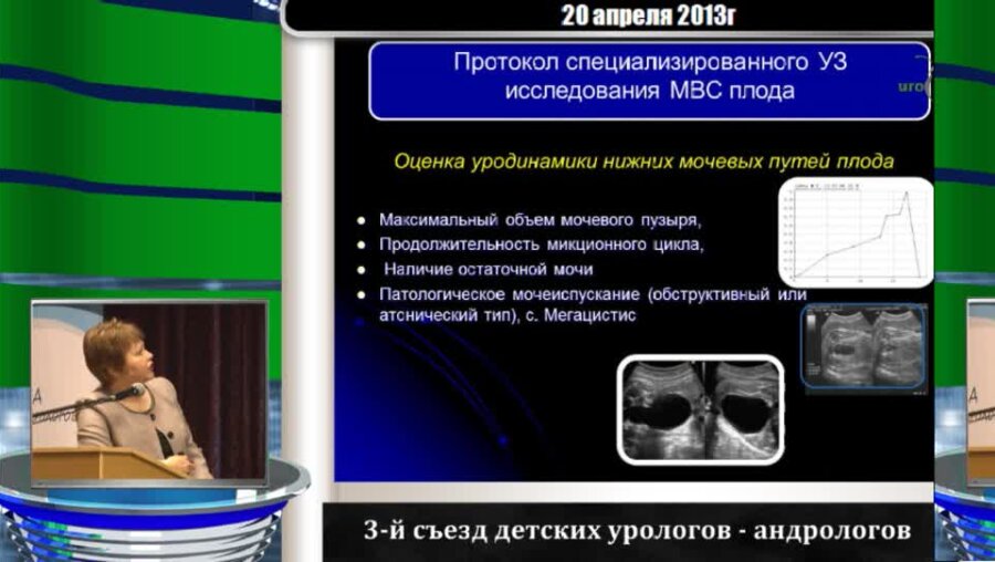 Дерюгина Л.А. "Разработка специализированного ульразвукового протокола Экспертного исследования мочевыделительной системы плода"