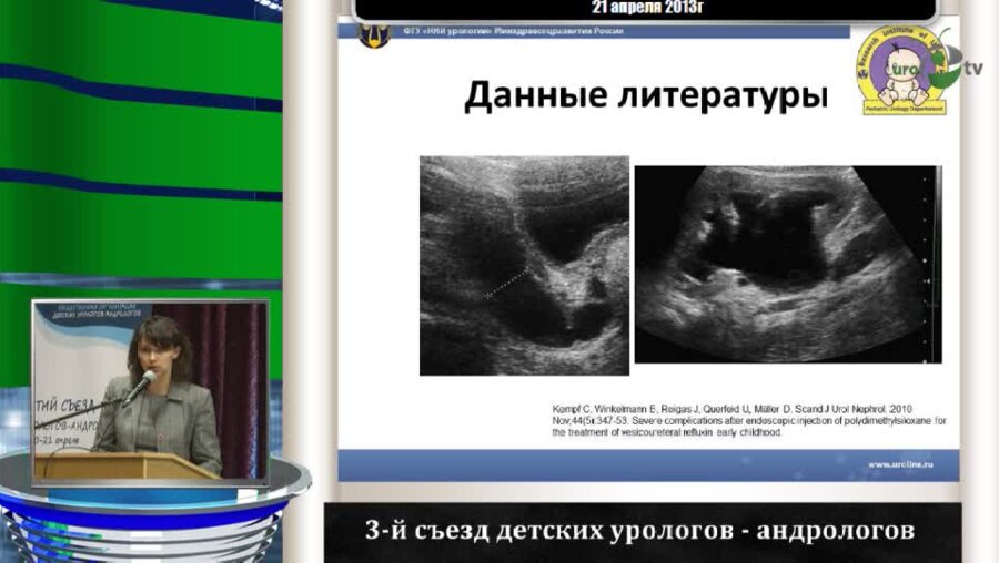 Гарманова Т.Н. "Снижение функции почки менее 70% - прогностический фактор возникновения обструкции устья мочеточника"