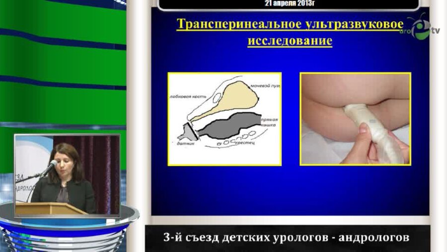 Джаватханова Р.И. "Неинвазивный метод диагностики парадоксального движения тазового дна"