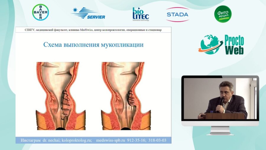 Нечай И.А. - Отдаленные результаты HAL RAR и LHP