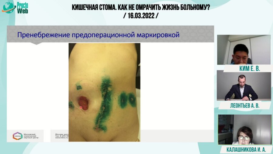 Леонтьев А.В. - Так делать не надо. Демонстрация клинический наблюдений «порочная кишечная стома»