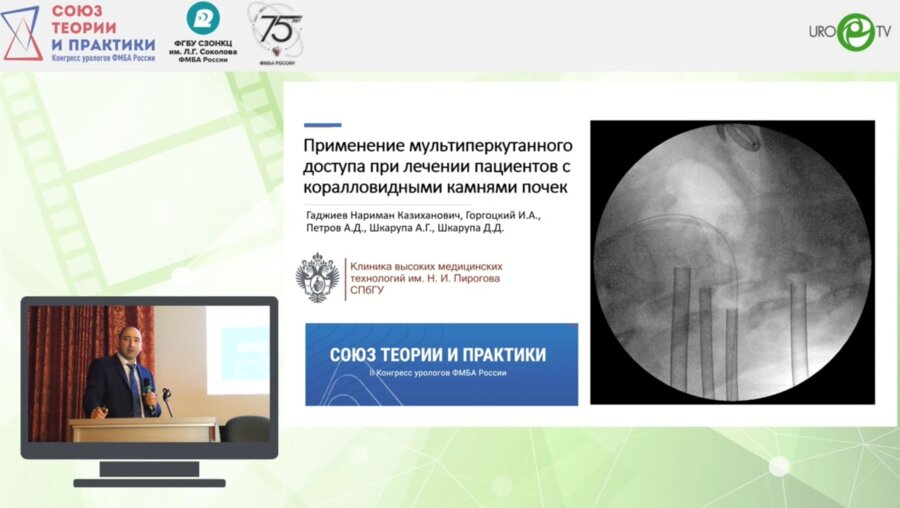 Гаджиев Н.К. - Применение мультиперкутанного доступа при лечении пациентов с коралловидными камнями почек