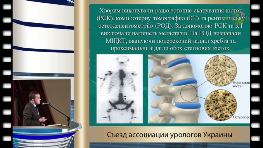 Черниченко О.А. - "Нарушения минеральной плотности костей у больных раком предстательной железы, которые получают интермитиручую гормонотерапию"