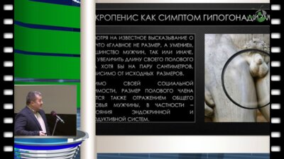 Р.Ю. Петрович - Консервативная терапия микропении у мужчин с гипогонадизмом