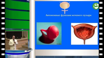 Б.А. Бердичевский - Роль цитомединов в терапии ДГПЖ