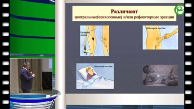 Жуков О.Б. - Нейрогенная эректильная дисфункция