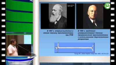 Воробьёв Н.В. - Промежностная радикальная простатэктомия: показания, технические особенности