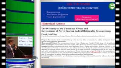 Васильев Л.А. - Простатсберегающая цистэктомия с ортотопической пластикой мочевого пузыря подвздошнокишечным J-резервуаром. Непосредственные и отдаленные результаты