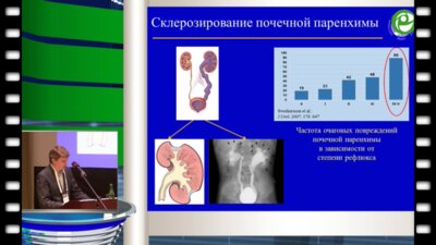 Шахновский Д.С. - Молекулярно-генетическая диагностика пузырно-мочеточникового рефлюкса