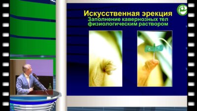 Рудин Ю.Э.  - Методы коррекции сложных пороков развития полового члена у детей и взрослых