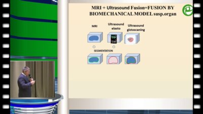 Жуков О.Б. - Интервенционные и фьюжн технологии в диагностике и лечении уроандрологических заболеваний