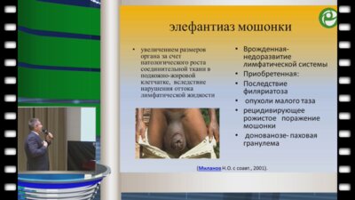 Жуков О.Б. - Оптимизация визуализирующих методик при элефантиазе мошонки