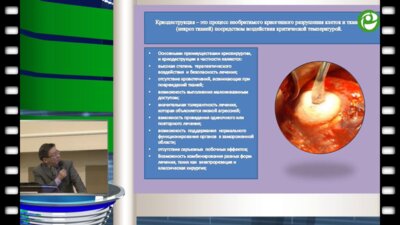 Кусымжанов С.М. - Эндолапароскопическая криодеструкция «малых» опухолей почек