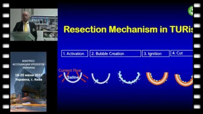 Удо Йонас - Обзор современных методов хирургического лечения в урологии